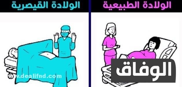 ايهما افضل الولادة الطبيعية ام القيصرية