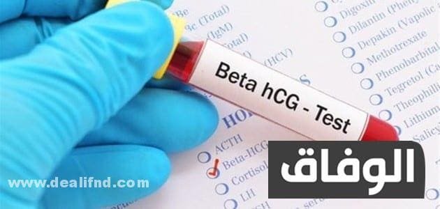 نسبة هرمون الحمل بعد الحقن المجهري