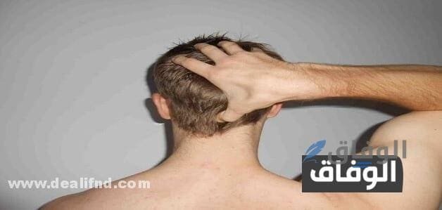 ألم فروة الرأس إسلام ويب