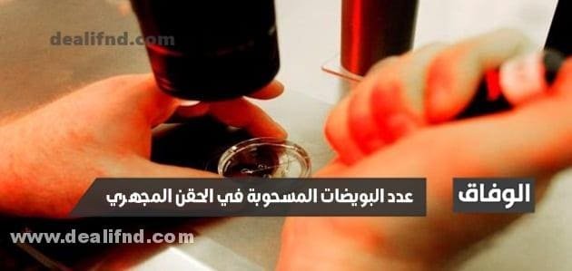 عدد البويضات المسحوبة في الحقن المجهري وكيف يتم ذلك ؟