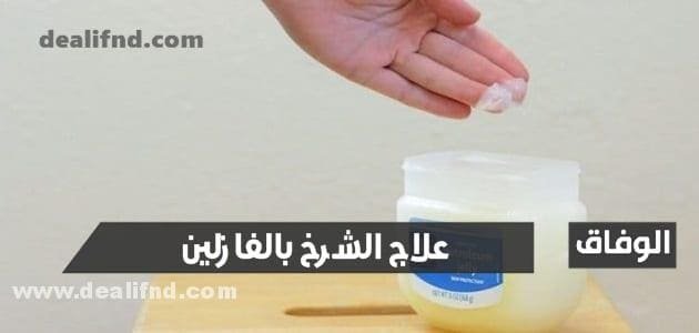 تجربتي في علاج الشرخ بالفازلين كااامله 2024