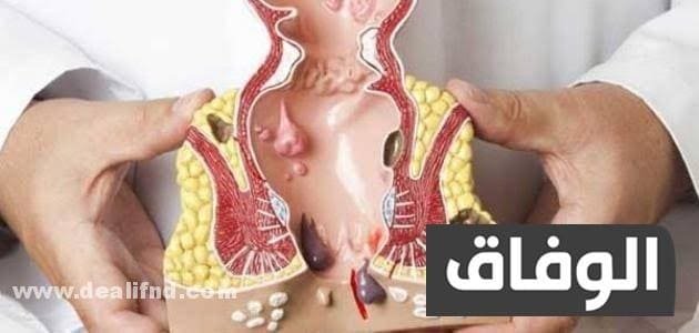 علاج سريع المفعول للشرخ | 12 طريقه فعاله ومجربة علاج سريع المفعول للشرخ في المنزل