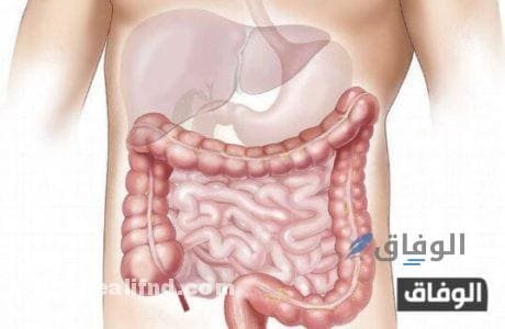 وجع القولون العصبي