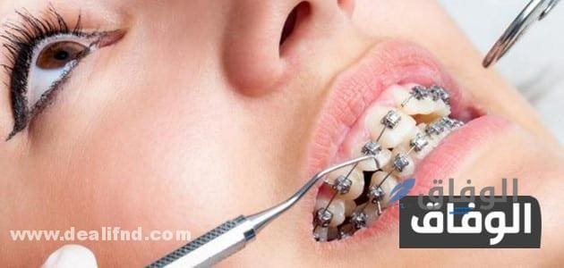 علاج اعوجاج الأسنان بدون تقويم