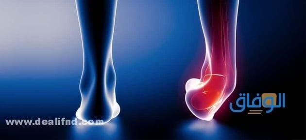 ألم كعب القدم المستمر