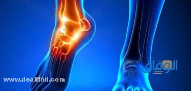 ألم كعب القدم المستمر