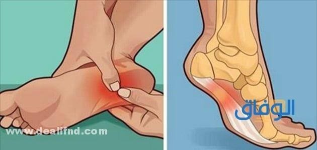 ألم كعب القدم اليمنى وطرق علاجه وأبرز أسبابه