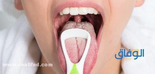 علاج احتقان الحلق والأنف