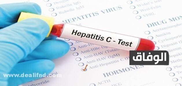 كمية الدم اللازمة لنقل فيروس سي