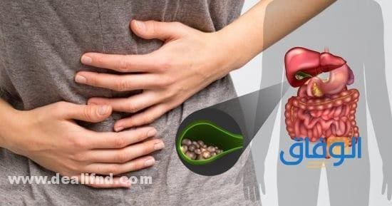 (أسرع 5 طرق علاج حصوة المرارة الكبيرة) 2024