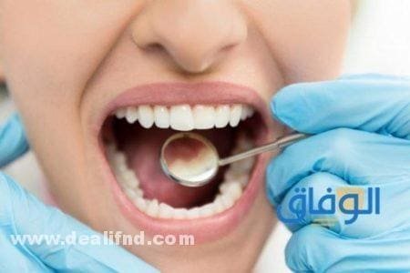 علاج التسوس العميق في المنزل بـ 8 طرق مختلفة وأسباب الإصابة به