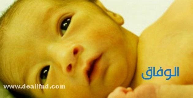 كيف يمكن علاج الصفراء في المنزل دون الذهاب للطبيب ؟