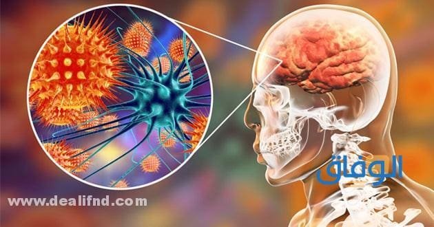 هل يمكن الشفاء من التهاب السحايا!؟ الأعراض والأسباب