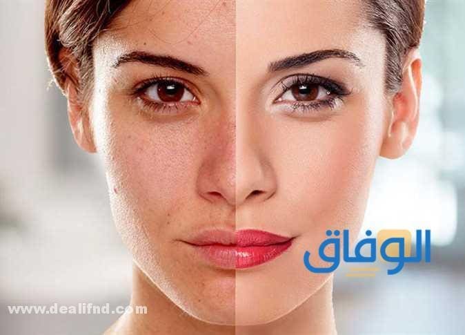 كريمات تفتيح البشرة