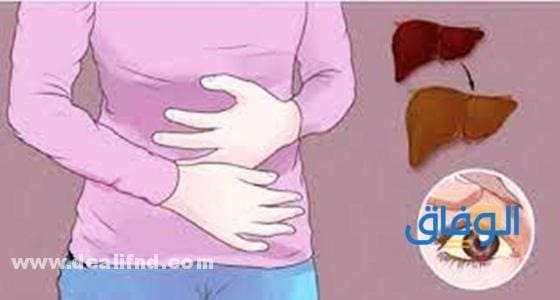 اعراض التهاب الكبد الوبائي – وأنواعه بالتفصيل >>