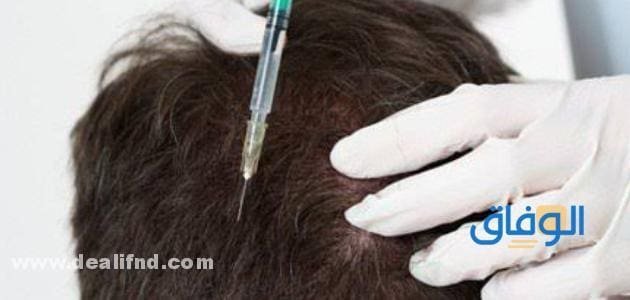 كولاجين الشعر للرجال (فوائد واضرار) 2024 أحدث أشكال الكولاجين لتعزيز نمو الشعر