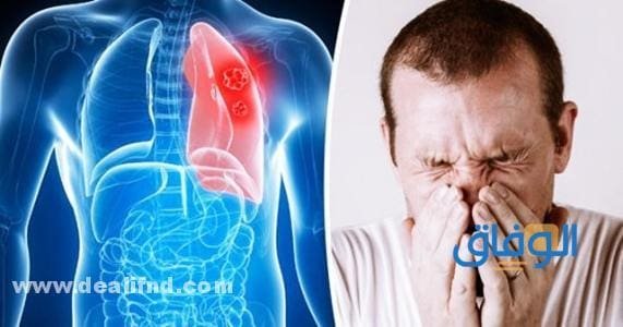 +06 (علامات تعب الرئه) الالتهاب الرئوي علامات تعب الرئه