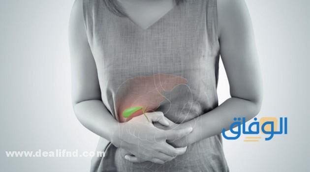 أعراض انفجار المرارة | علاج تمزق المرارة