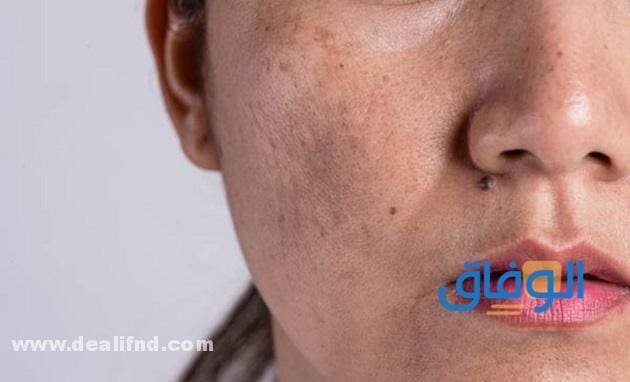 كريم تصبغات