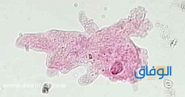 أعراض الأميبا - واسبابها، وعلاجها amoeba أعراض الأميبا