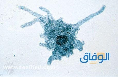 أعراض الأميبا - واسبابها، وعلاجها amoeba أعراض الأميبا