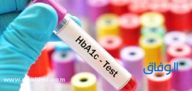 اسعار تحاليل معمل البرج (كافة أنواع التحاليل) 2026 أسعار مختبرات البرج