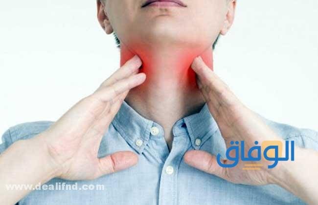 علاج حرقان الحلق