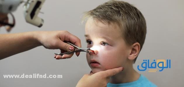 أعراض اللحمية