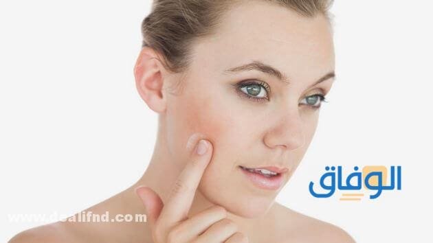 كريم اليكاسال Elicasal | دواعي الاستعمال والاثار الجانبية كريم اليكاسال للشفايف