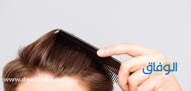 انواع قشرة الشعر بالصور