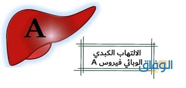 علامات الشفاء من التهاب الكبد الوبائي أ – مدة الشفاء