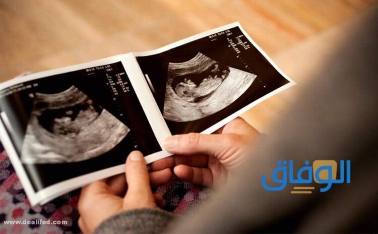رموز ورقة السونار