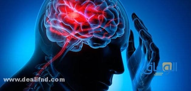 +05 (أعراض الجلطة الخفيفة) وكيفية التشخيص
