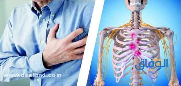 التهاب الصدر