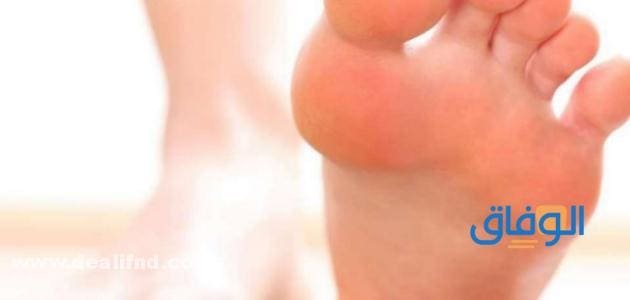 علاج (تقشر القدمين) بخلطات ومنتجات | مجربة ومشهورة واقتصادية تقشر القدمين