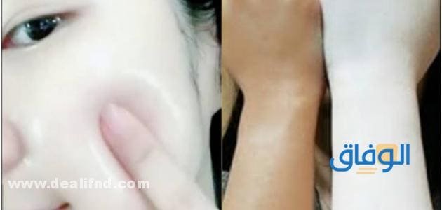 +05 مكونات سحرية لعمل (خلطات تبيض الجسم كامل) تعرفي عليهم