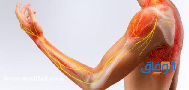 أسباب آلام العضلات والاعصاب؟ وكيفية علاجها  أسباب آلام العضلات والاعصاب
