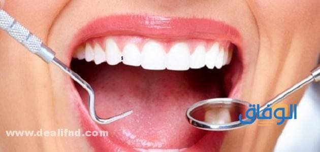اسعار تنظيف الاسنان
