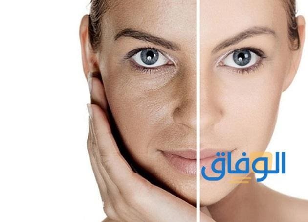 +05 علاج التصبغات الجلدية العميقة عن تجربة !! طرق التخلص من التصبغات الجلدية