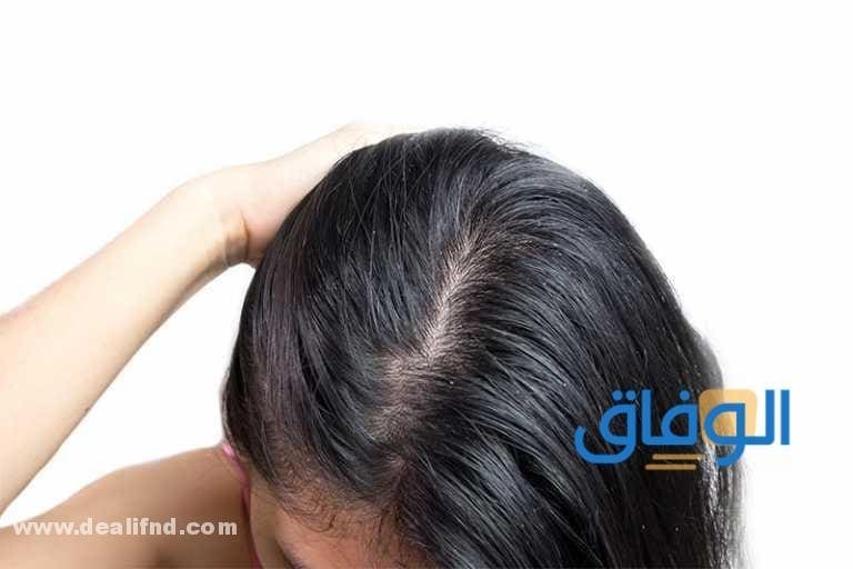 أفضل شامبو للشعر الدهني