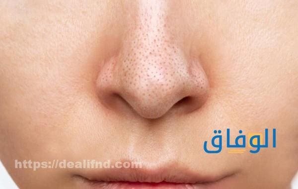 الرؤوس السوداء للبشرة 15 طريقة للحصول على بشرة صافية ما هي الرؤوس السوداء؟