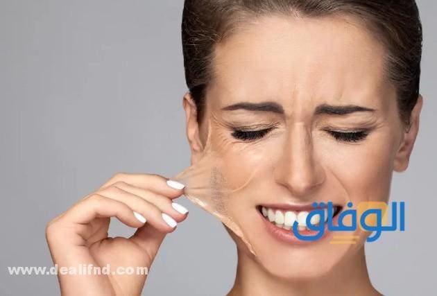 التقشير البارد في المنزل