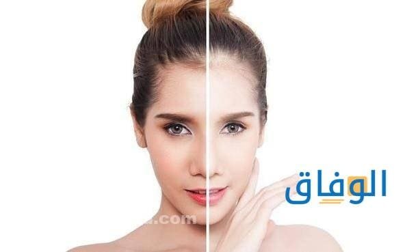 أبرة النضارة أهم 6 فوائد و03 أضرار