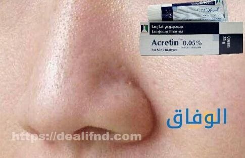 اكرتين الأنف: فوائد استخدامه وطرق تطبيقه بشكل صحيح
