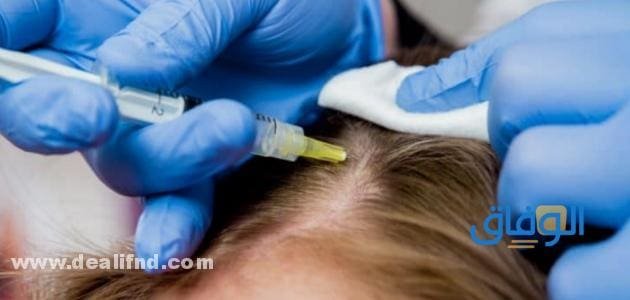 فوائد البلازما للشعر | ونصائح مهمة قبل الحقن مجربة ومضمونة 100%