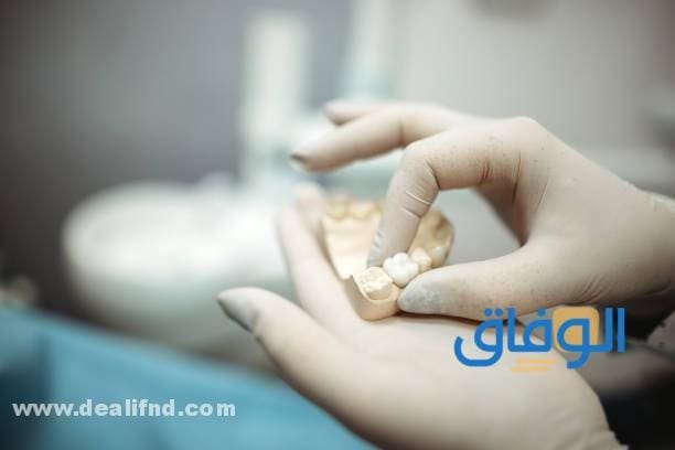 اسعار حشو الاسنان