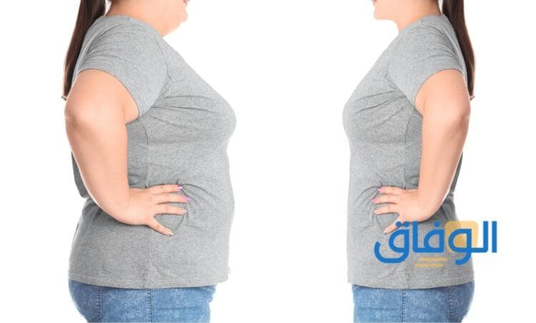 تجربتي مع تجميد الدهون تجربتي مع تجميد الدهون