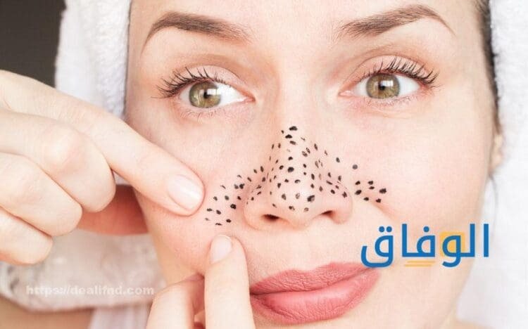 إزالة الرؤوس السوداء