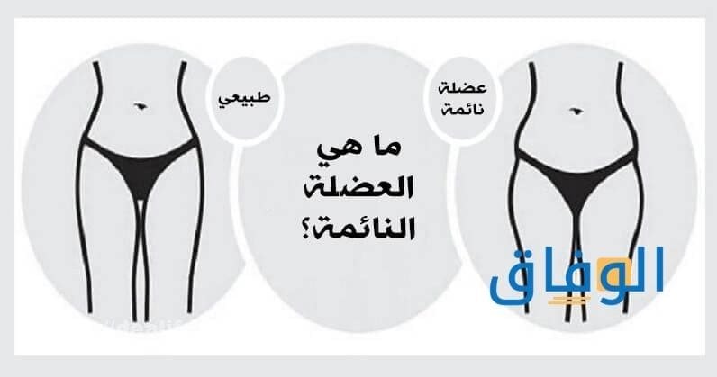 العضلة النائمة