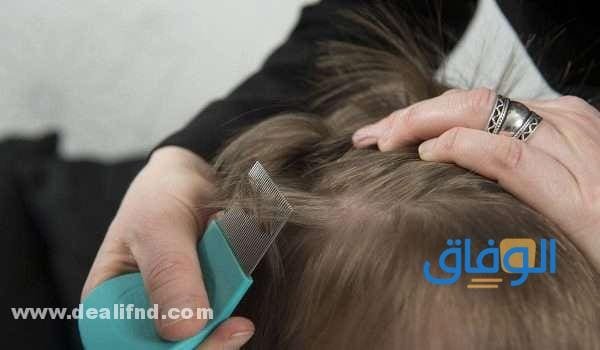 علاج القمل للأطفال علاج القمل للأطفال